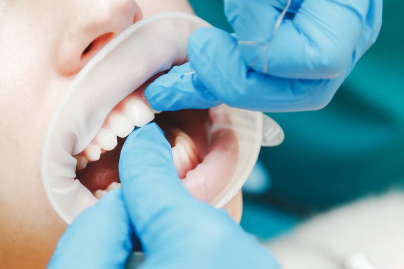 Anatomía dental: nombres y funciones de los dientes
