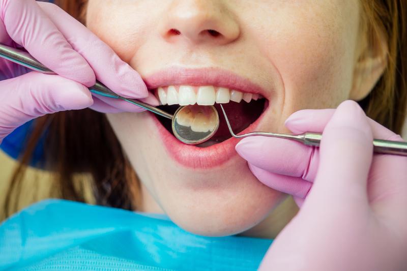 Cómo la falta de calcio impacta en la salud de tus dientes